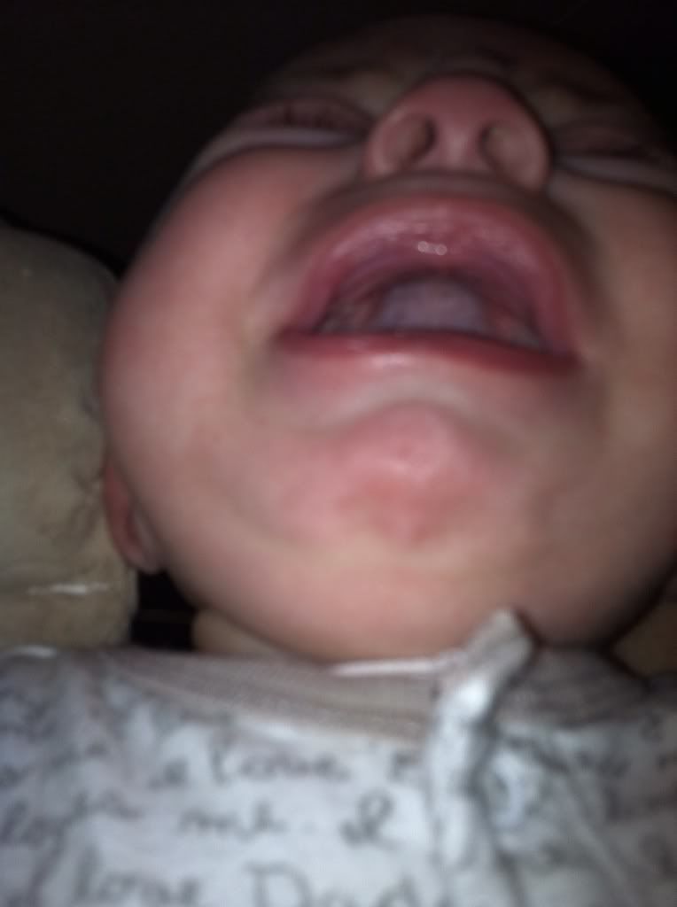 White spot in babies gums? BabyCenter